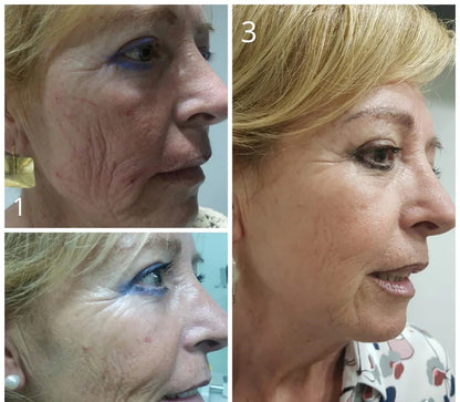 LuminSkin™ 6 in 1 LED + CREMA MIXSOON DE REGALO