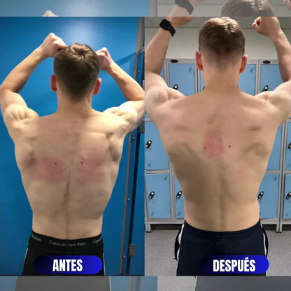 Corrector de Postura FitPosture™