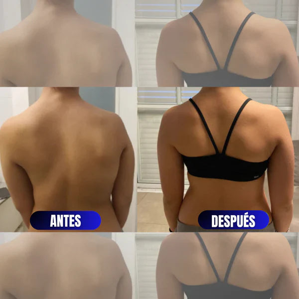 Corrector de Postura FitPosture™