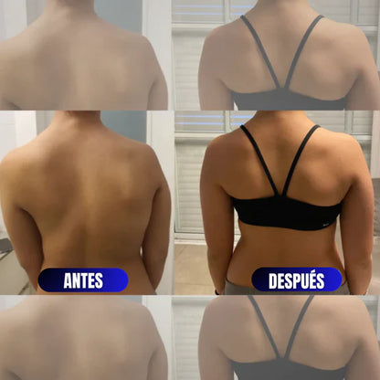 Corrector de Postura FitPosture™